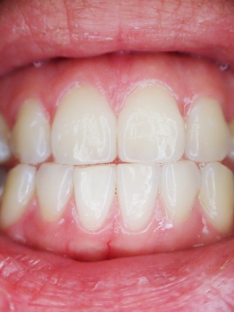 Quatre astuces pour avoir une bouche saine