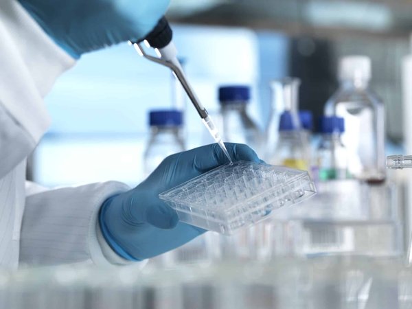 Comment réaliser un test ADN origine ?